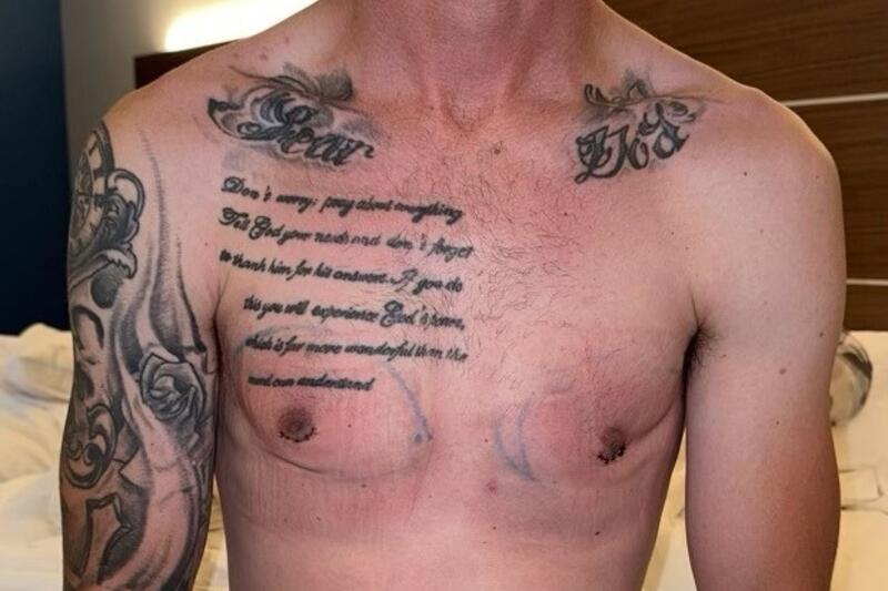 Patient Before & After Image