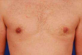 Patient Before & After Image