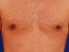 Patient Before & After Image