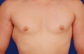 Patient Before & After Image