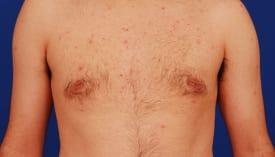 Patient Before & After Image