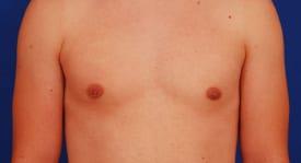 Patient Before & After Image