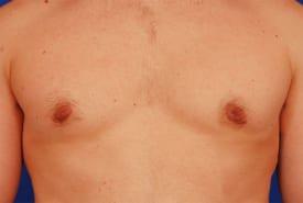 Patient Before & After Image