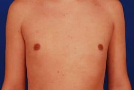 Patient Before & After Image