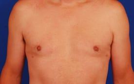 Patient Before & After Image