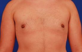 Patient Before & After Image