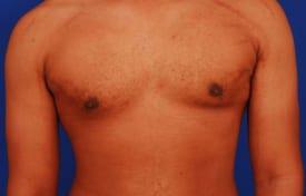 Patient Before & After Image