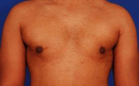 Patient Before & After Image