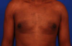 Patient Before & After Image