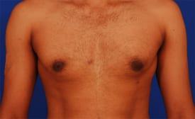 Patient Before & After Image