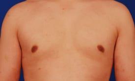 Patient Before & After Image