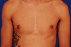 Patient Before & After Image