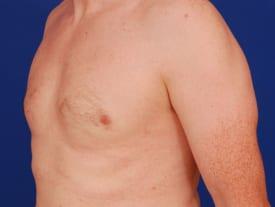 Patient Before & After Image