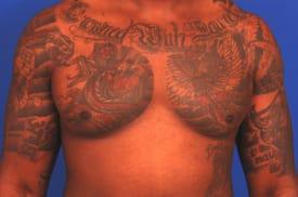 Patient Before & After Image