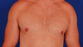 Patient Before & After Image