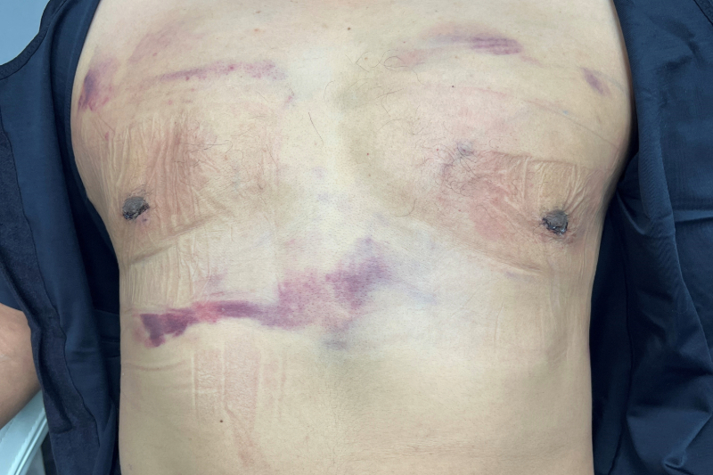 Patient Before & After Image