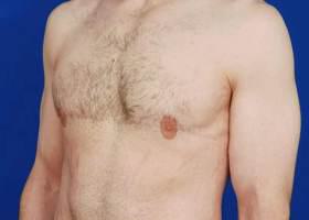 Patient Before & After Image