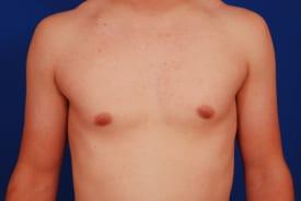 Patient Before & After Image