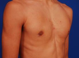 Patient Before & After Image