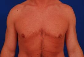 Patient Before & After Image