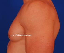 Patient Before & After Image