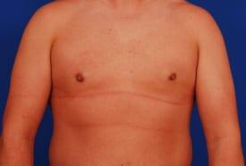 Patient Before & After Image