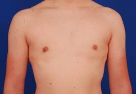 Patient Before & After Image