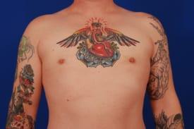 Patient Before & After Image