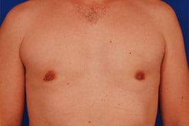 Patient Before & After Image