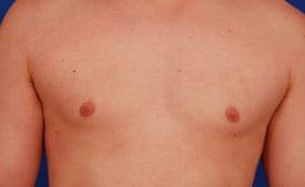 Patient Before & After Image