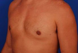 Patient Before & After Image