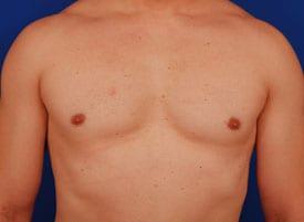 Patient Before & After Image