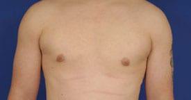 Patient Before & After Image