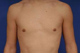 Patient Before & After Image