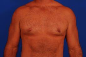 Patient Before & After Image