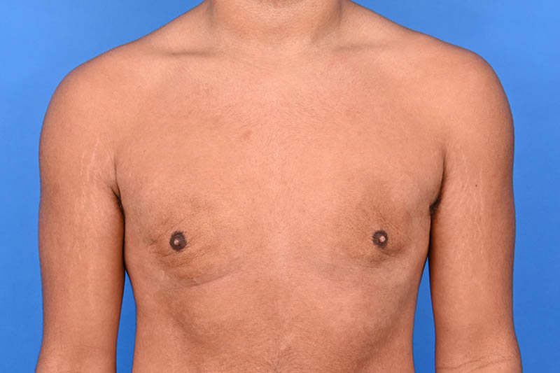 Patient Before & After Image