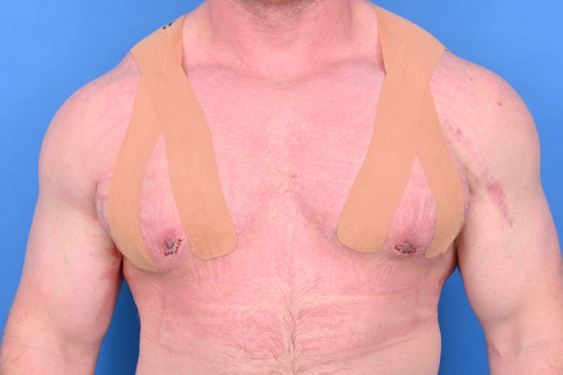 Patient Before & After Image