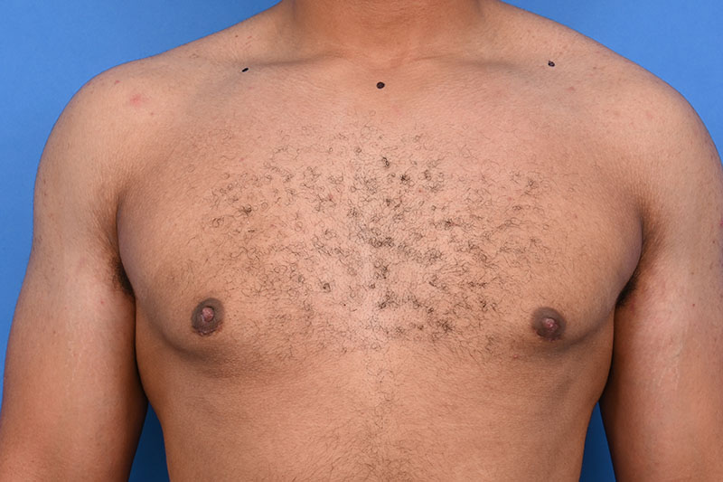 Patient Before & After Image