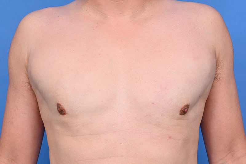 Patient Before & After Image