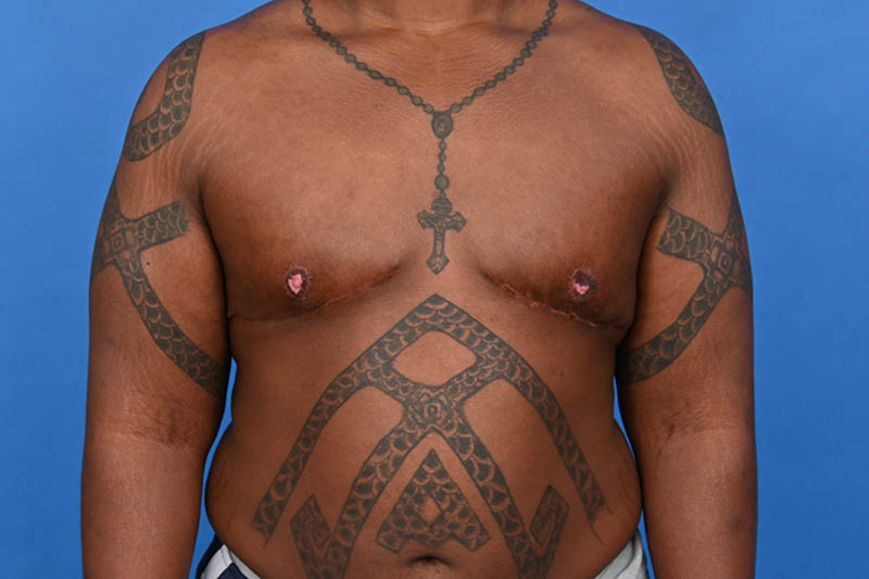 Patient Before & After Image