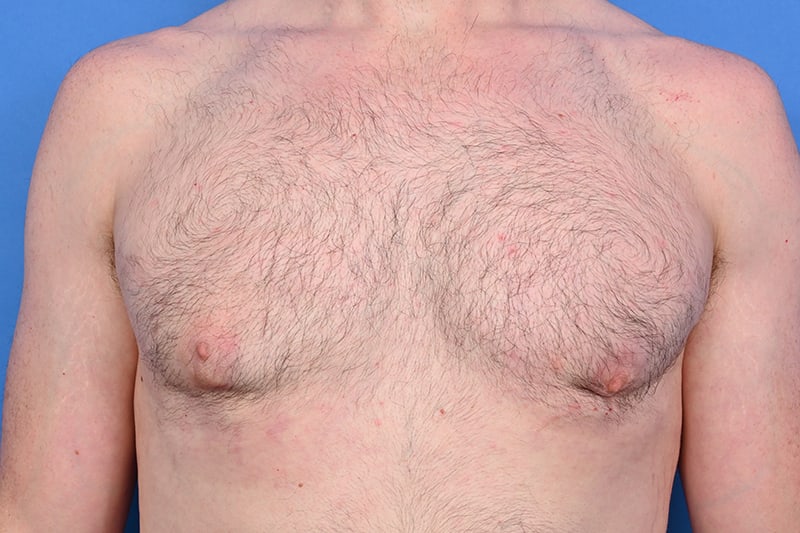 Patient Before & After Image