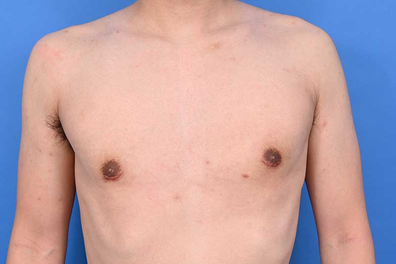 Patient Before & After Image