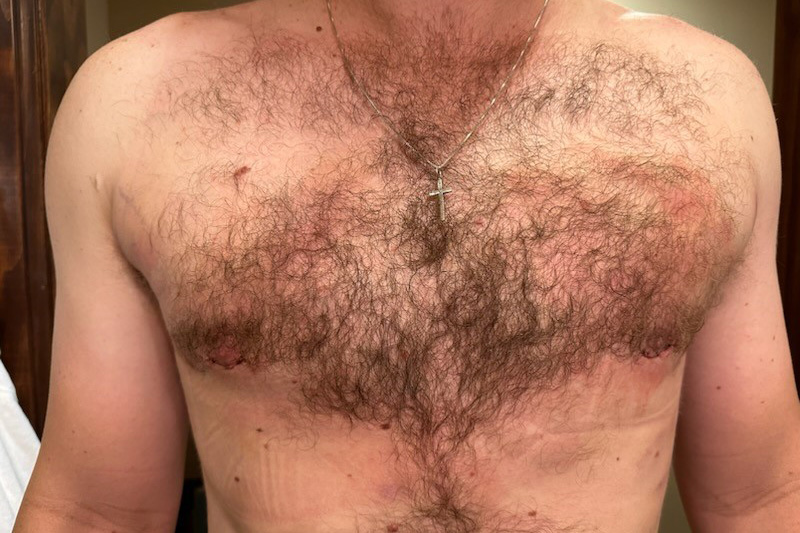 Patient Before & After Image