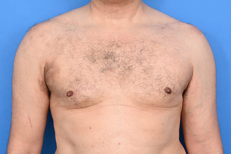 Patient Before & After Image