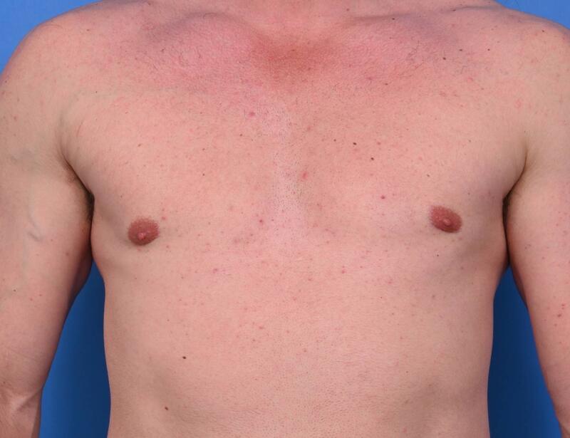 Patient Before & After Image