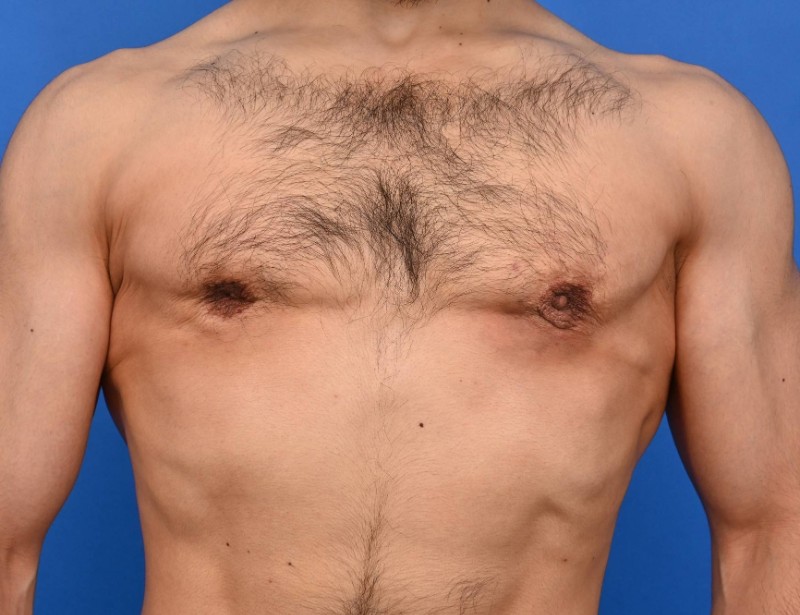 Patient Before & After Image