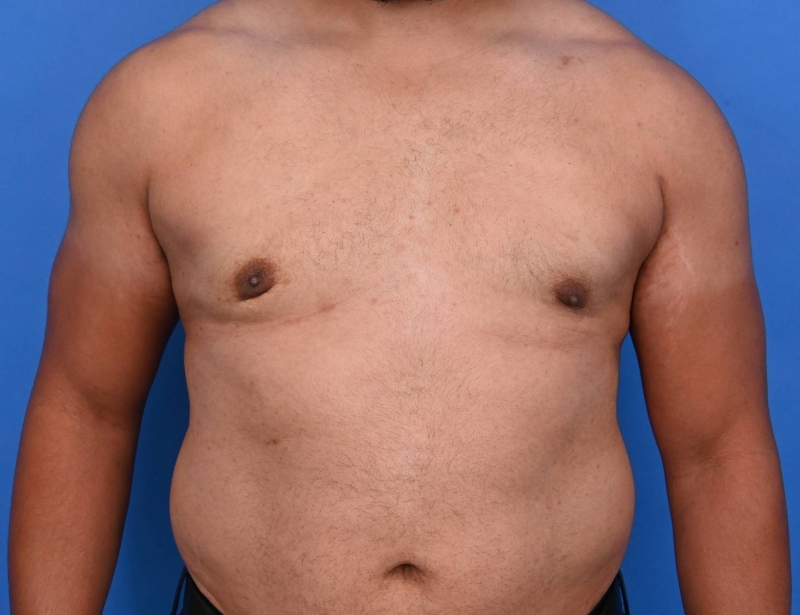 Patient Before & After Image