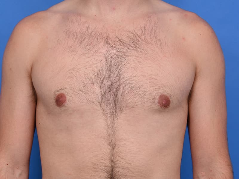 Patient Before & After Image