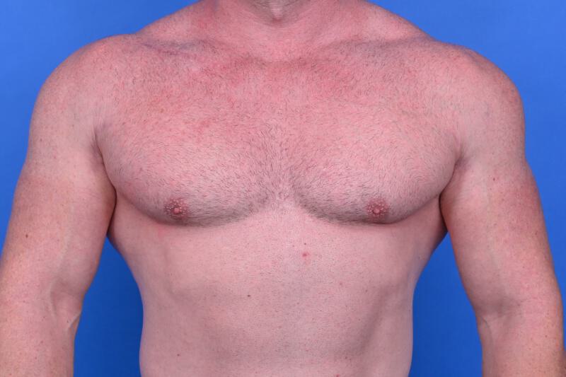 Patient Before & After Image