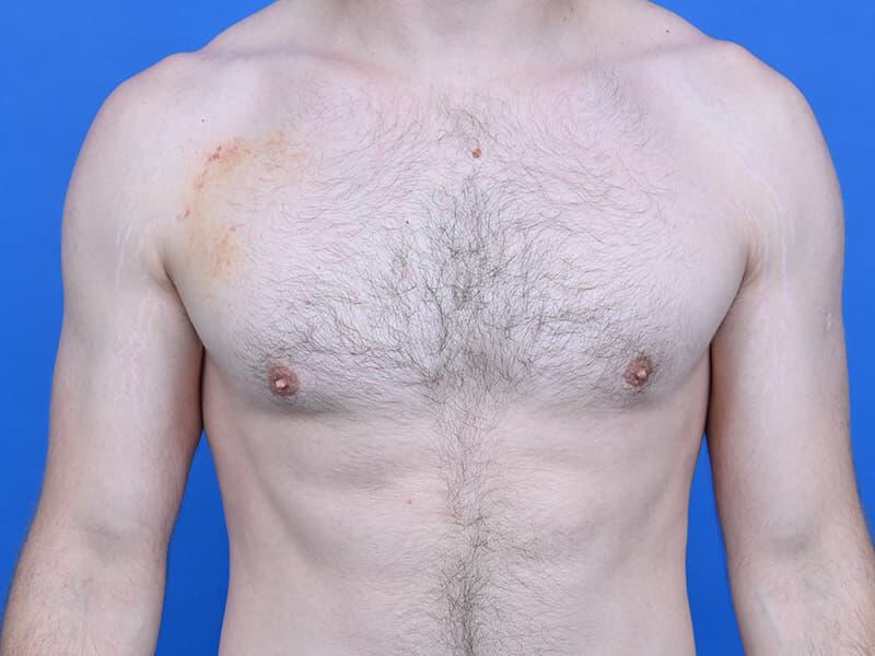 Patient Before & After Image